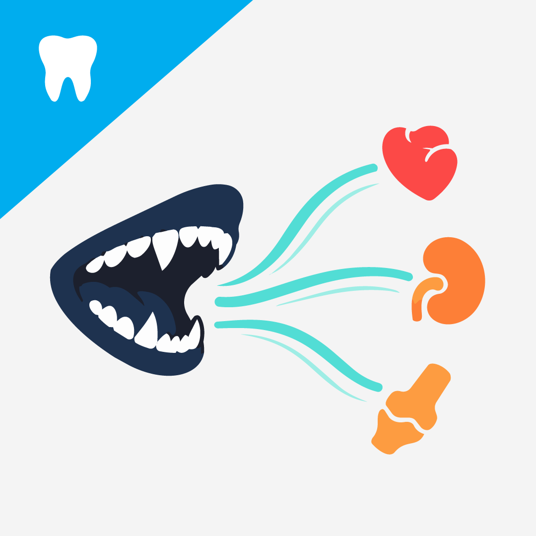 Can Dental Health Affect the Heart, Kidneys and Joints? (The Oral-Systemic Link)
