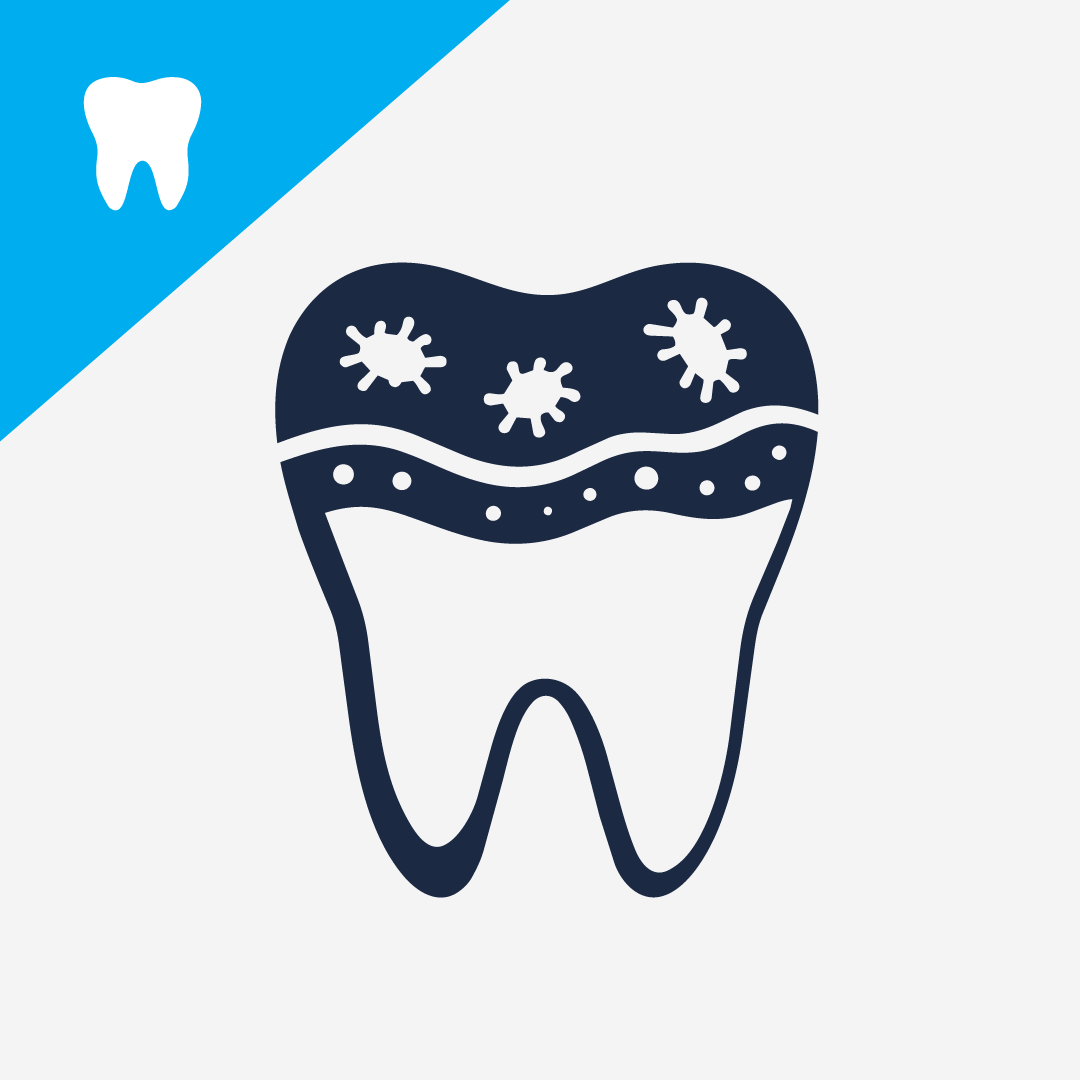 Understanding Plaque in Dogs: Causes, Composition, and Prevention